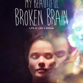 My Beautiful Broken Brain (2016)
